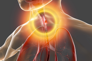 346. Esophageal Perforations