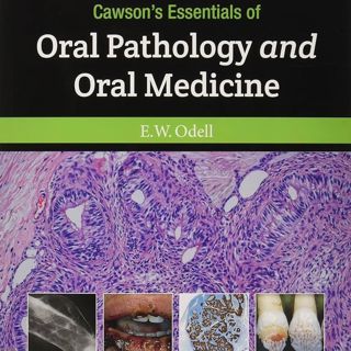 Cawson's Essentials of Oral Pathology and Oral Medicine