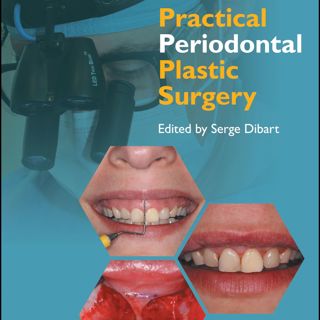 Practical Periodontal Plastic Surgery