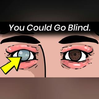 What Having a Cat Does to Your Eyes
