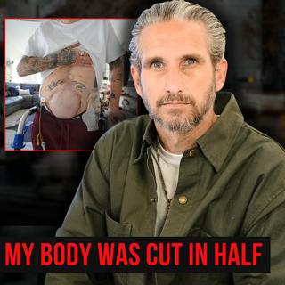 "I Was Cut In Half On Impact" | Pronounced Dead 3 Times, A 3.5 Week Coma & I Performed Surgery On Myself