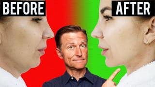 Fastest Way to Rid Your DOUBLE CHIN (Turkey Neck)