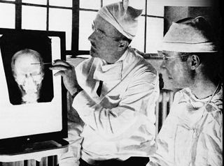 Walter Freeman, and the Lobotomy