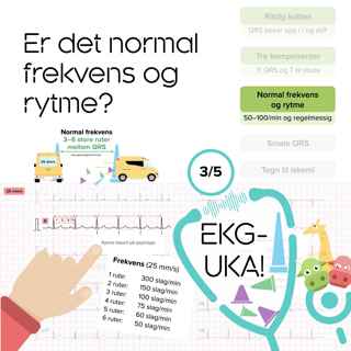 03 Er det normal frekvens og rytme?