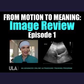 From Motion to Meaning: ULA Image Review Episode 1