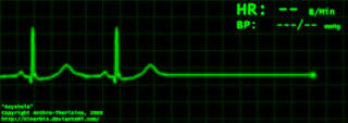 Podcast #319: Cardiac Arrest Survival Factors