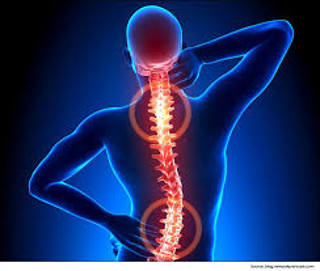 Podcast # 345: Epidural Abscess