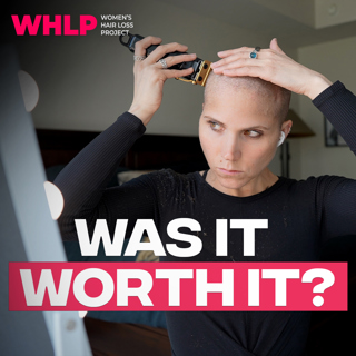 2 Years Later: Why I Shaved My Head for Hair Loss — Was It Worth It?