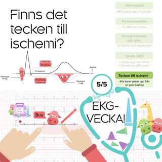 Finns det tecken till ischemi?