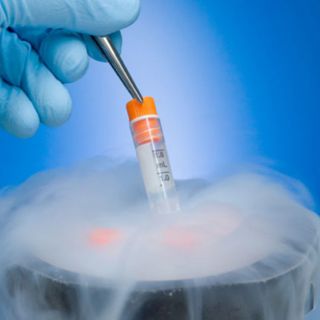 #380: Freezing Eggs