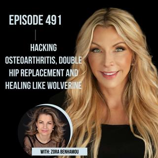 491. Hacking Osteoarthritis, Double Hip Replacement and Healing Like Wolverine with Zora Benhamou
