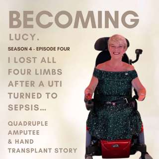 I Lost All Four Limbs After a UTI Turned to Sepsis… | Quadruple Amputee & Hand Transplant