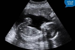 Miscarriage and Stillbirth: Dealing with Loss