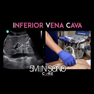 5 Minute Sono - IVC