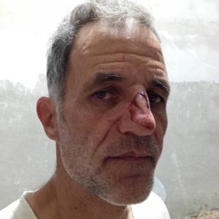 Solidarity in the face of fascism: Updates from Gaza to SCOTUS