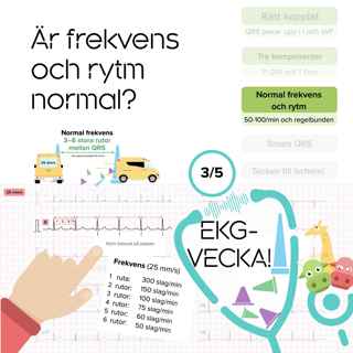 03 Är frekvens och rytm normal?
