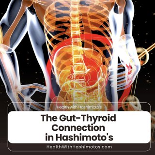 178 // The Gut-Thyroid Connection in Hashimoto's: Simple Steps from Super Gut