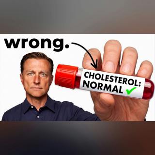 What is Normal Cholesterol (What Your Doctor Doesn’t Tell You)