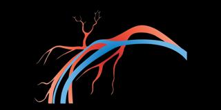 290. Pulmonary Embolisms and Deep Vein Thrombosis