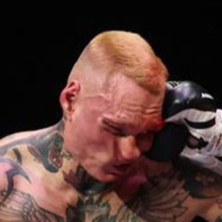 Rozicki's Chin Is Unbelievable