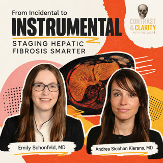 21. From Incidental to Instrumental: Staging Hepatic Fibrosis Smarter
