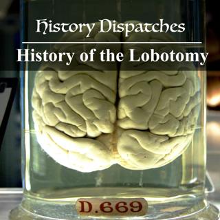 History of the Lobotomy