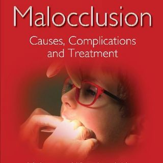 Malocclusion: Causes, Complications and Treatment (Dentistry and Oral Sciences)