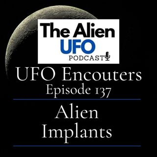 The Alien Implant Phenomenon