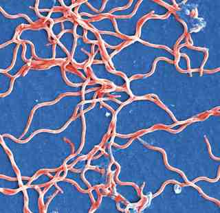 TWiM #122: Mayonii, microRNAs and the microbiome